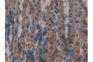 Detection of LIFR in Mouse Stomach Tissue using Polyclonal Antibody to Leukemia Inhibitory Factor Receptor (LIFR)