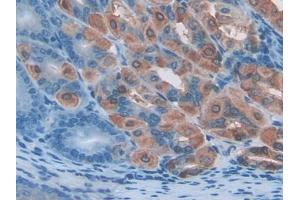 DAB staining on IHC-P; Samples: Mouse Stomach Tissue