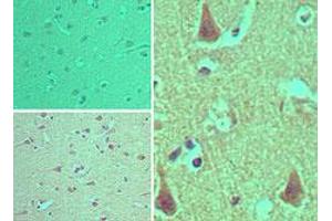 Image no. 1 for anti-ArfGAP with RhoGAP Domain, Ankyrin Repeat and PH Domain 2 (ARAP2) (AA 1670-1720) antibody (ABIN960081)