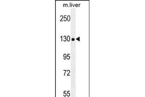 COL18A1 Antibody (Center) (ABIN654663 and ABIN2844359) western blot analysis in mouse liver tissue lysates (35 μg/lane). (COL18A1 anticorps  (AA 1311-1339))
