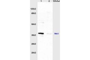 Lane 1: mouse liver lysates Lane 2: mouse intestine lysates probed with Anti HSD17B1/HSD17 Polyclonal Antibody, Unconjugated  at 1:200 in 4˚C. (HSD17B1 anticorps  (AA 21-120))