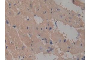 Detection of ICAM2 in Rat Heart Tissue using Polyclonal Antibody to Intercellular Adhesion Molecule 2 (ICAM2) (ICAM2 anticorps  (AA 29-247))