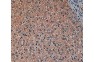Used in DAB staining on fromalin fixed paraffin-embedded Liver tissue (LAP anticorps  (AA 320-519))