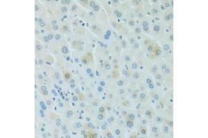Immunohistochemistry of paraffin-embedded mouse liver using PDC antibody (ABIN6293719) at dilution of 1:100 (40x lens). (Phosducin anticorps)