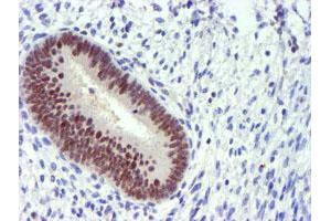 Immunohistochemical staining of paraffin-embedded Human endometrium tissue using anti-PDSS2 mouse monoclonal antibody. (PDSS2 anticorps)