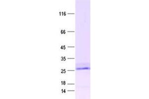 Validation with Western Blot