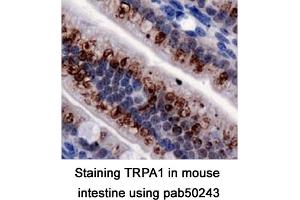 Image no. 2 for anti-Transient Receptor Potential Cation Channel, Subfamily A, Member 1 (TRPA1) (AA 1-100), (N-Term) antibody (ABIN363552) (TRPA1 anticorps  (N-Term))