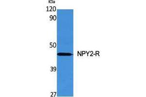 Western Blot (WB) analysis of specific cells using NPY2-R Polyclonal Antibody.