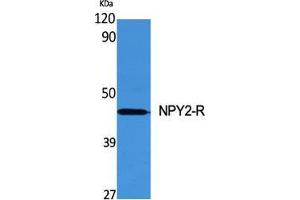 Western Blot (WB) analysis of specific cells using NPY2-R Polyclonal Antibody. (NPY2R anticorps  (N-Term))