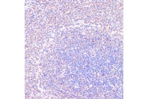Immunohistochemistry of paraffin-embedded rat spleen using RXRG antibody (ABIN6128667, ABIN6147330, ABIN6147331 and ABIN6219010) at dilution of 1:100 (40x lens). (Retinoid X Receptor gamma anticorps  (AA 1-137))