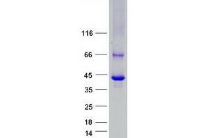 Validation with Western Blot
