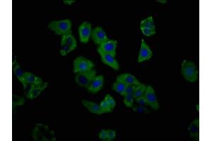 Immunofluorescence staining of HepG2 cells with ABIN7154230 at 1:333, counter-stained with DAPI.