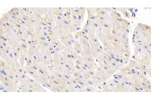 Detection of LEP in Bovine Cardiac Muscle Tissue using Polyclonal Antibody to Leptin (LEP)