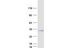 Validation with Western Blot