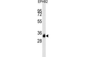 Western Blotting (WB) image for anti-EPH Receptor B2 (EPHB2) antibody (ABIN2927898) (EPH Receptor B2 anticorps)