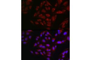 Immunofluorescence analysis of U2OS cells using METTL4 Rabbit pAb (ABIN6133091, ABIN6143773, ABIN6143774 and ABIN6224964) at dilution of 1:100 (40x lens).