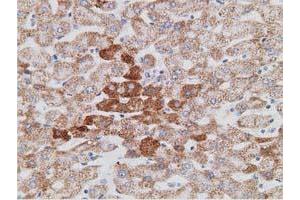 Immunohistochemical staining of paraffin-embedded Human liver tissue using anti-PECR mouse monoclonal antibody. (PECR anticorps)