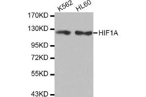 Western Blotting (WB) image for anti-Hypoxia Inducible Factor 1, alpha Subunit (Basic Helix-Loop-Helix Transcription Factor) (HIF1A) antibody (ABIN1980281) (HIF1A anticorps)