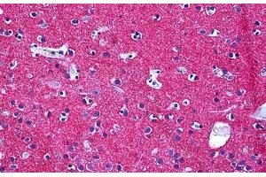 Human Brain, Neuropil: Formalin-Fixed, Paraffin-Embedded (FFPE)