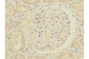 Immunohistochemistry of paraffin-embedded human kidney tissue using ABIN7168009 at dilution of 1:100 (RHOBTB1 anticorps  (AA 240-400))