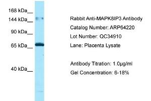 Western Blotting (WB) image for anti-Mitogen-Activated Protein Kinase 8 Interacting Protein 3 (MAPK8IP3) (N-Term) antibody (ABIN2789770) (JIP3 anticorps  (N-Term))