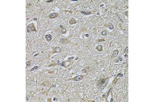 Immunohistochemistry of paraffin-embedded human brain cancer using WIPI1 Antibody. (WIPI1 anticorps)