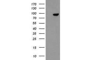 Image no. 4 for anti-F-Box Protein 42 (FBXO42) (AA 356-717) antibody (ABIN1491450)