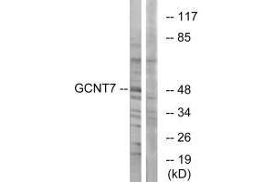 Western blot analysis of extracts from K562 cells, using GCNT7 antibody. (GCNT7 anticorps)