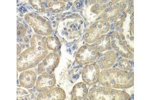 Immunohistochemistry of paraffin-embedded Rat kidney using ACSL5 Polyclonal Antibody at dilution of 1:100 (40x lens). (ACSL5 anticorps)