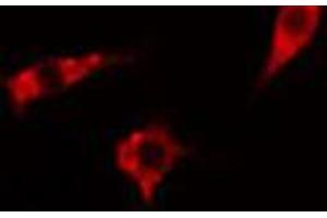 ABIN6267570 staining Hela cells by IF/ICC. (ADAM17 anticorps  (pThr735))
