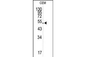 Western blot analysis of KLF5 antibody in CEM cell line lysates (35ug/lane) (KLF5 anticorps  (AA 127-156))