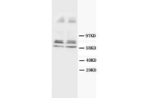 Western Blotting (WB) image for anti-Glial Fibrillary Acidic Protein (GFAP) antibody (ABIN1107345) (GFAP anticorps)