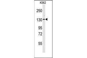 Image no. 1 for anti-Valyl-tRNA Synthetase (VARS) (N-Term) antibody (ABIN360195) (VARS anticorps  (N-Term))