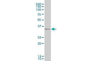 CXCR4 monoclonal antibody (M04), clone 2G9.
