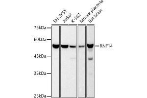 Western blot analysis of extracts of various cell lines, using RNF14 antibody (ABIN7270060) at 1:500 dilution. (RNF14 anticorps)