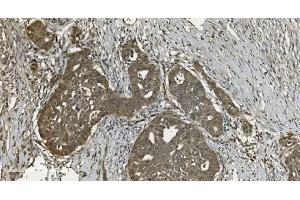 IHC analysis of U2AF65/U2AF2 using anti U2AF65/U2AF2 antibody (ABIN7600794). (U2AF2 anticorps  (AA 238-470))