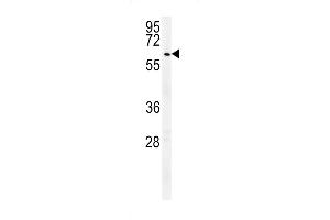 Western blot analysis in HepG2 cell line lysates (35ug/lane). (UBP17 anticorps  (C-Term))