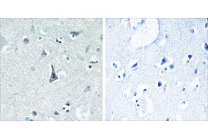 Peptide - +Immunohistochemistry analysis of paraffin-embedded human brain tissue using Cytochrome P450 3A4 antibody. (CYP3A4 anticorps)