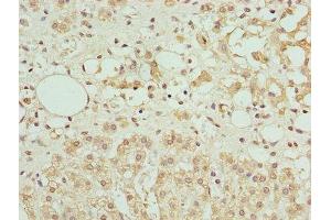 Immunohistochemistry of paraffin-embedded human adrenal gland tissue using ABIN7144341 at dilution of 1:100 (Antizyme Inhibitor 1 anticorps  (AA 101-400))