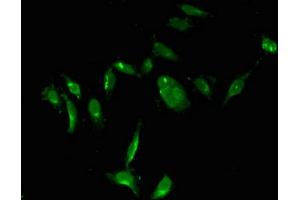Immunofluorescent analysis of Hela cells using ABIN7172123 at dilution of 1:100 and Alexa Fluor 488-congugated AffiniPure Goat Anti-Rabbit IgG(H+L)