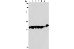 Western Blotting (WB) image for anti-Adenylate Kinase 2 (AK2) antibody (ABIN2422842) (Adenylate Kinase 2 anticorps)