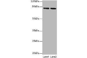 Western blot All lanes: FOLH1 antibody at 2 μg/mL Lane 1: U251 whole cell lysate Lane 2: PC-3 whole cell lysate Secondary Goat polyclonal to rabbit IgG at 1/10000 dilution Predicted band size: 85, 13, 10, 78, 83, 81, 79, 51 kDa Observed band size: 85 kDa (PSMA anticorps  (AA 48-750))
