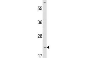 Western blot analysis of VHL antibody and HepG2 lysate.