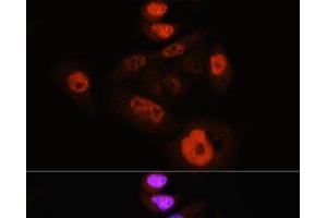 Immunofluorescence analysis of HeLa cells using Phospho-YAP1(S127) Polyclonal Antibody at dilution of 1:100 (40x lens). (YAP1 anticorps  (pSer127))