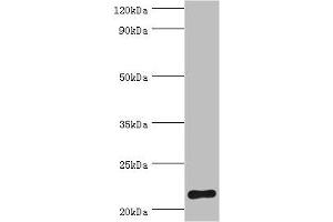 Western blot All lanes: Suppressor of cytokine signaling 2 antibody at 2 μg/mL + HepG2 whole cell lysate Secondary Goat polyclonal to rabbit IgG at 1/10000 dilution Predicted band size: 22 kDa Observed band size: 22 kDa (SOCS2 anticorps  (AA 1-198))