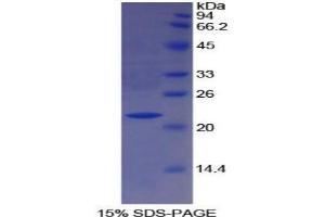 SDS-PAGE analysis of Human Paraoxonase 1 Protein. (PON1 Protéine)