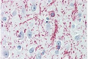 Human Brain, Cortex (formalin-fixed, paraffin-embedded) stained with MBP antibody ABIN364503 at 1:100 followed by biotinylated goat anti-rabbit IgG secondary antibody ABIN481713, alkaline phosphatase-streptavidin and chromogen. (MBP anticorps)