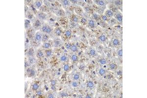 Immunohistochemistry of paraffin-embedded mouse liver using SND1 antibody at dilution of 1:100 (40x lens). (SND1 anticorps)