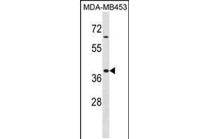 Western blot analysis in MDA-MB453 cell line lysates (35ug/lane). (HOXA9 anticorps  (AA 160-189))