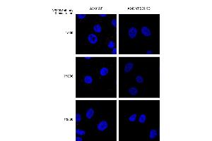 Immunocytochemistry/Immunofluorescence analysis using Mouse Anti-VPS35 Monoclonal Antibody, Clone 10A8 (ABIN6932981).